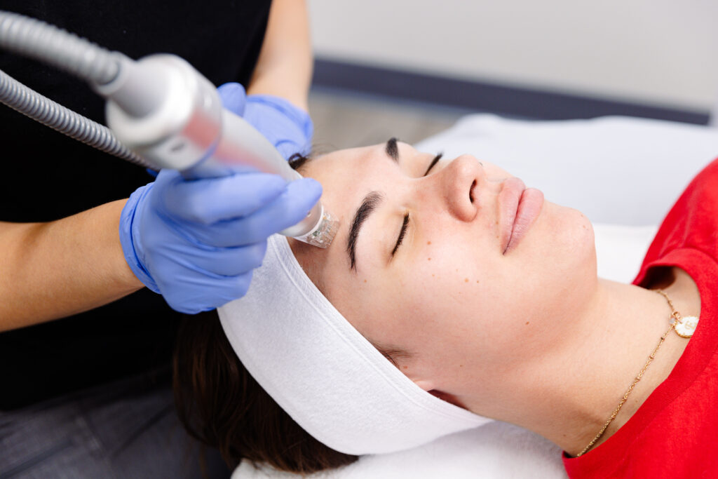 A woman in a red shirt closes her eyes as she receives RF microneedling near Leawood