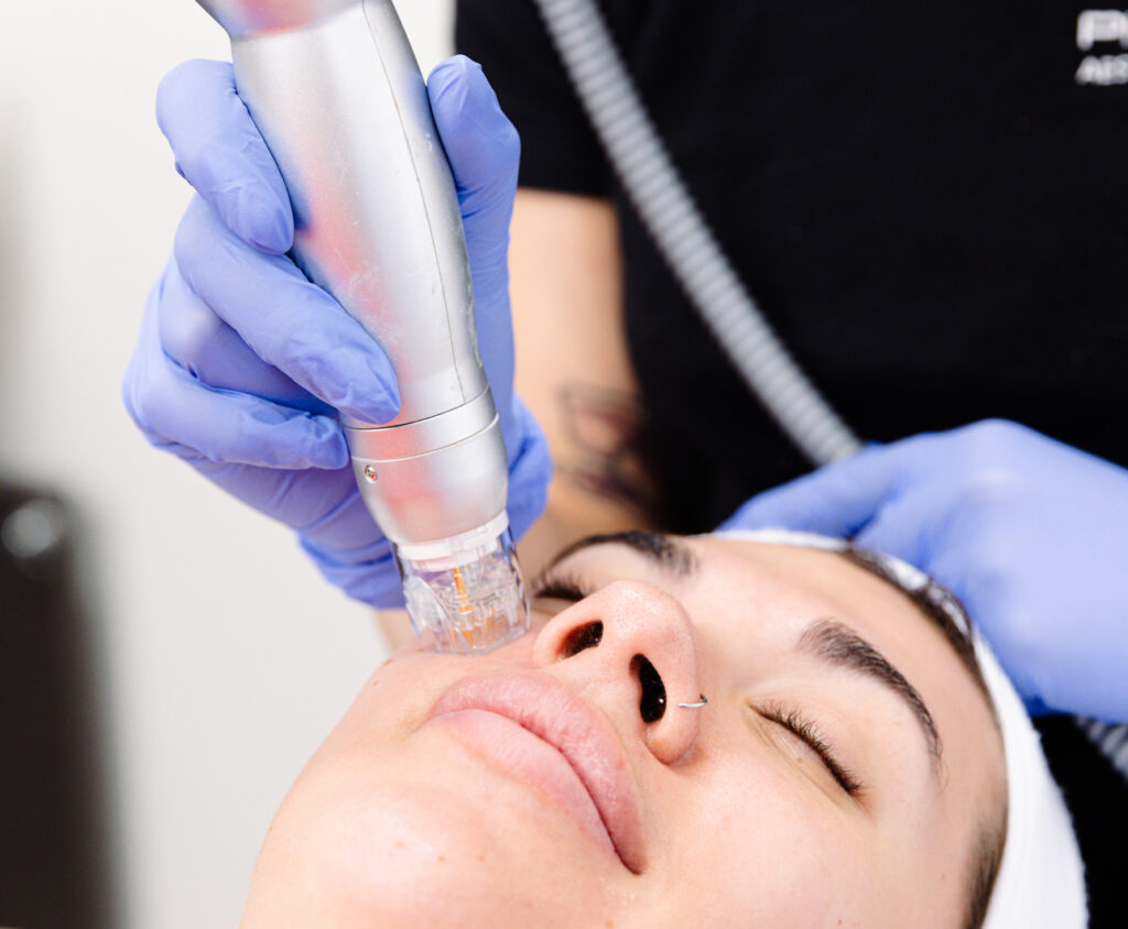 A woman shuts her eyes and relaxes as a provider with blue gloves performs a treatment for Scarlet RF in Lenexa