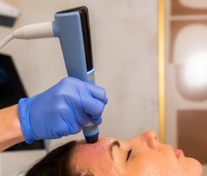 A provider wearing blue medical gloves performs a skin resurfacing in Lenexa.