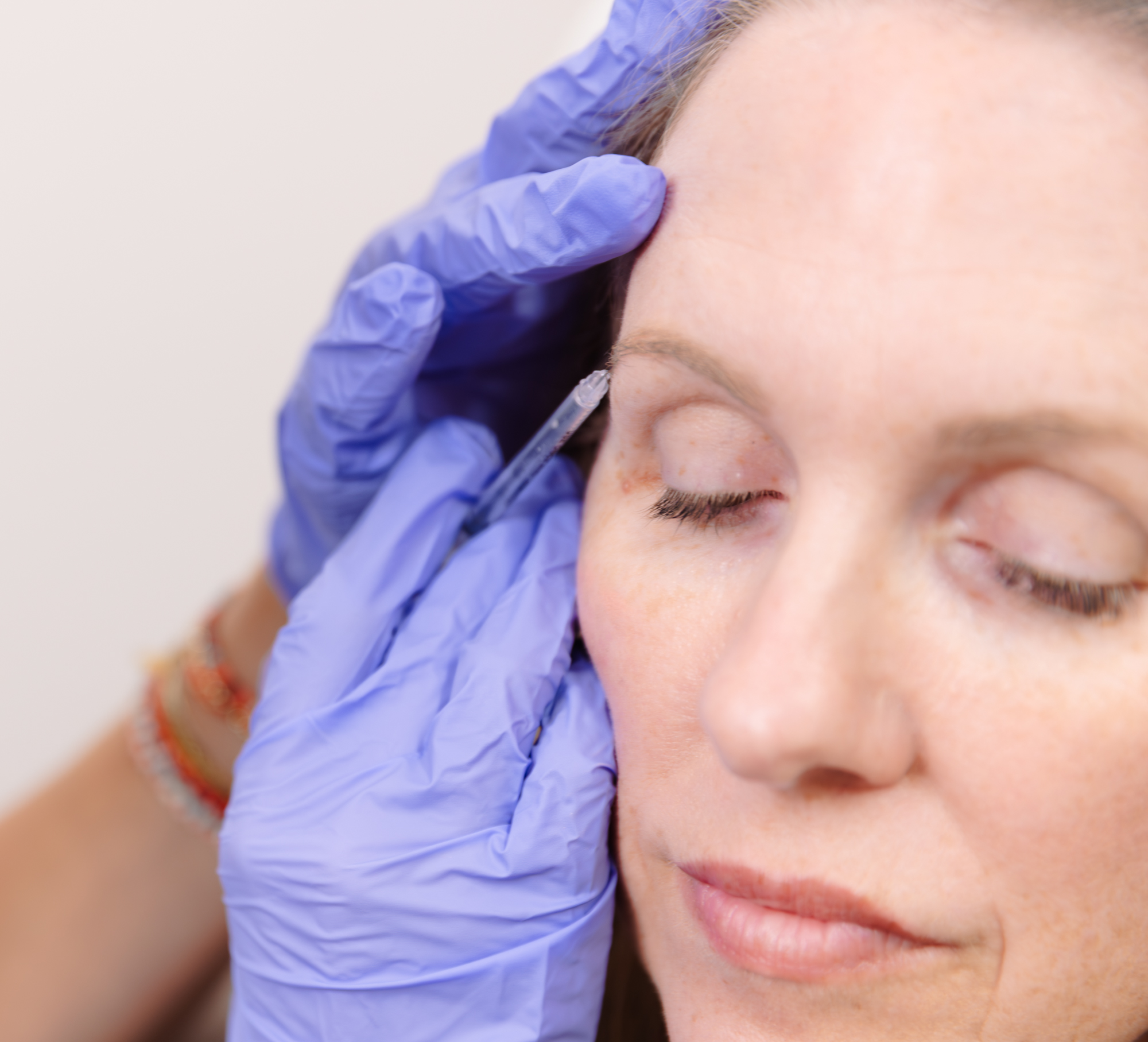 Physician Aesthetic Specialists patient receiving a wrinkle relaxer injection near the eye
