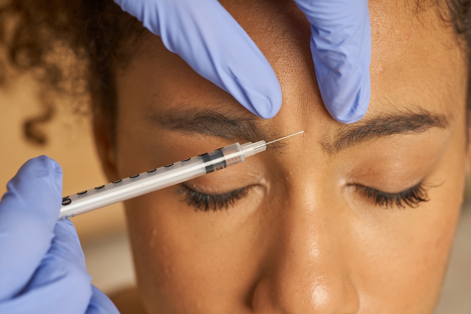 Patient receiving a dermal filler injection at Physician Aesthetic Specialists