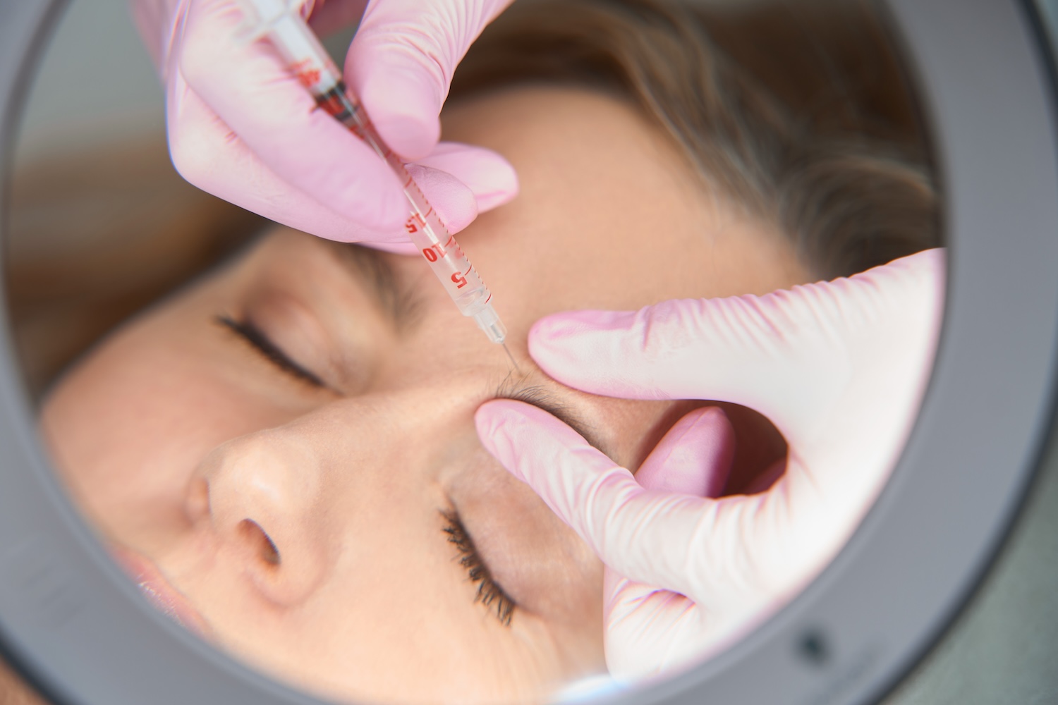 Dermal filler injection treatment at Physician Aesthetic Specialists
