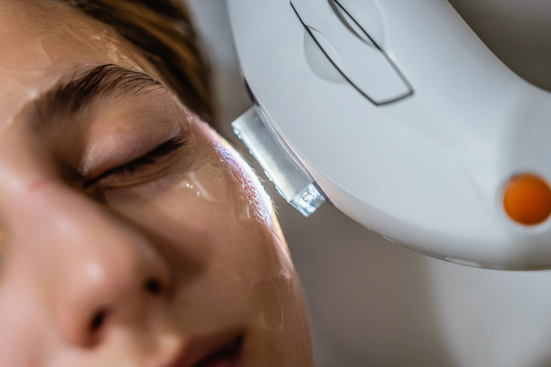 A patient undergoes Laser Skin Tightening near Leawood